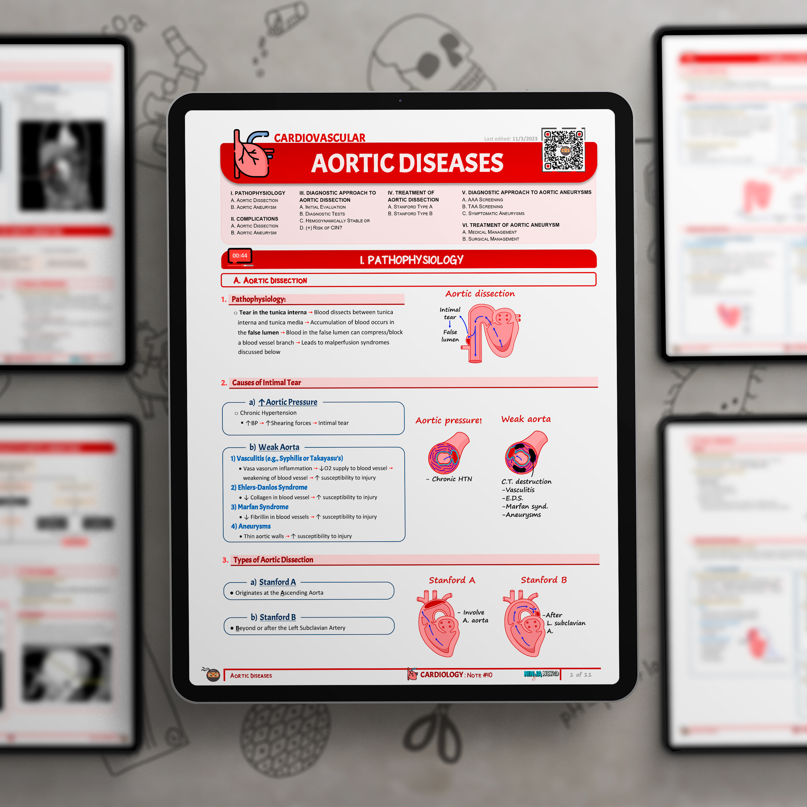 Aortic Diseases