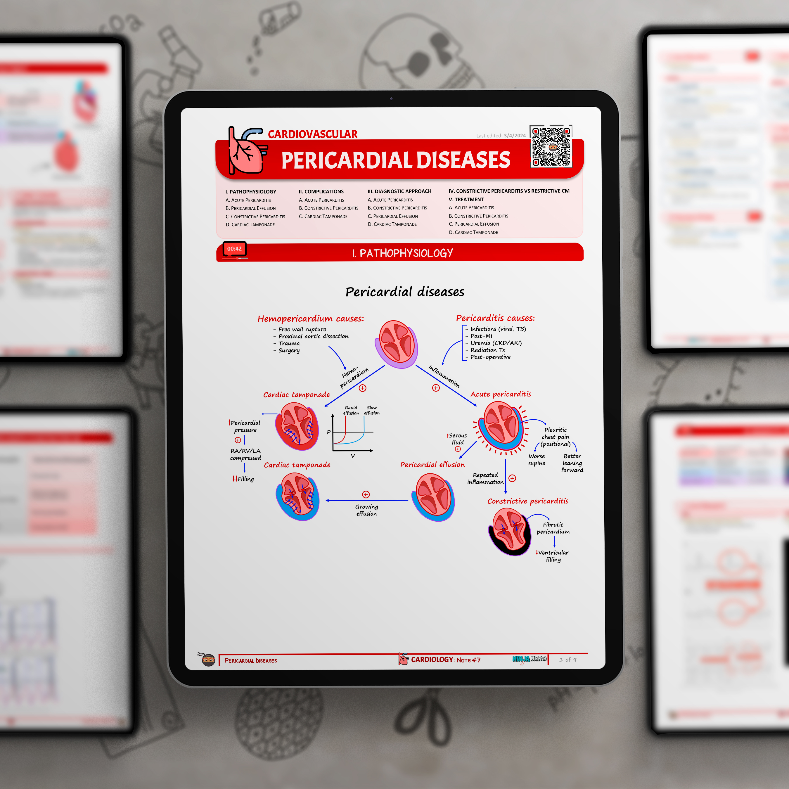 Pericardial Diseases