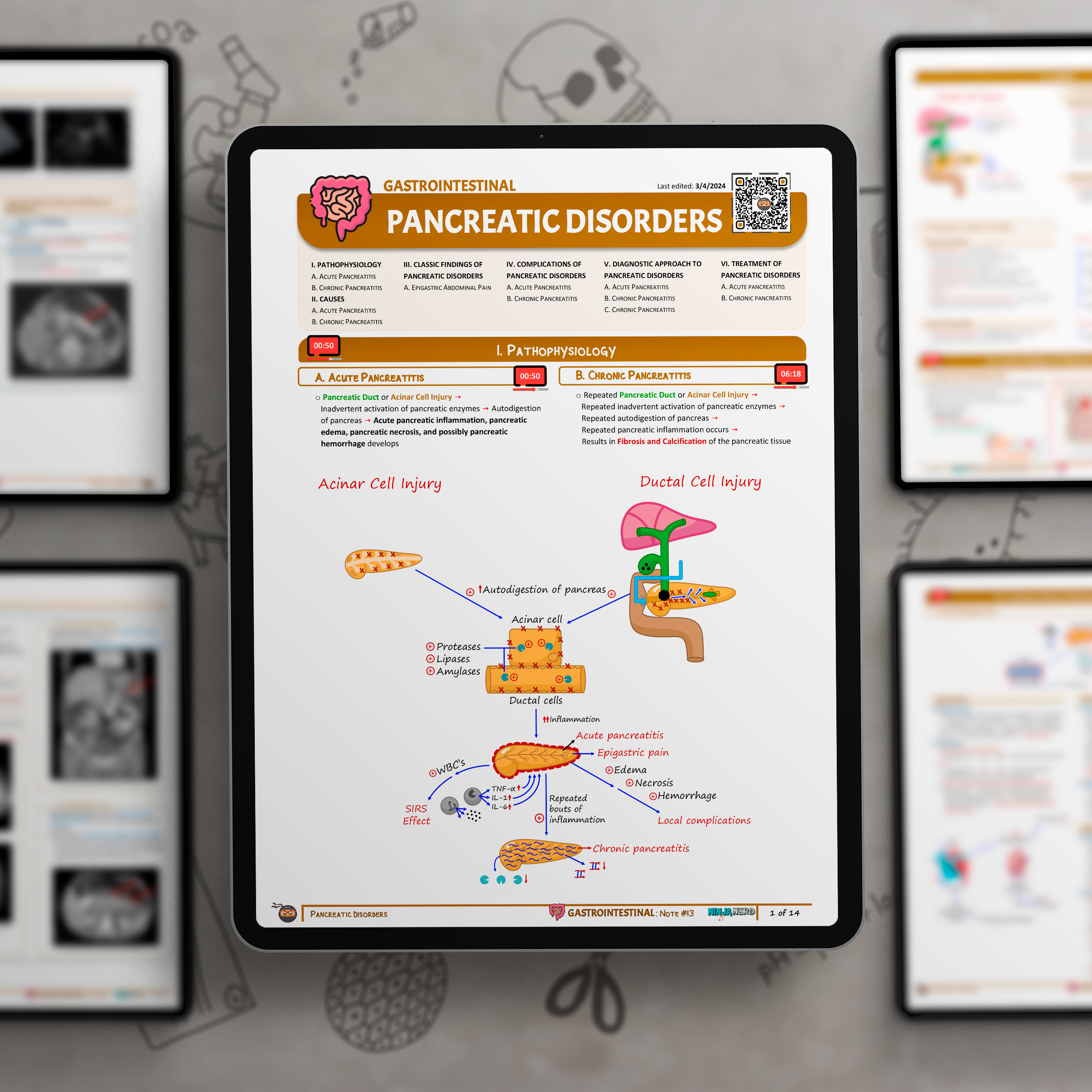 Pancreatitis