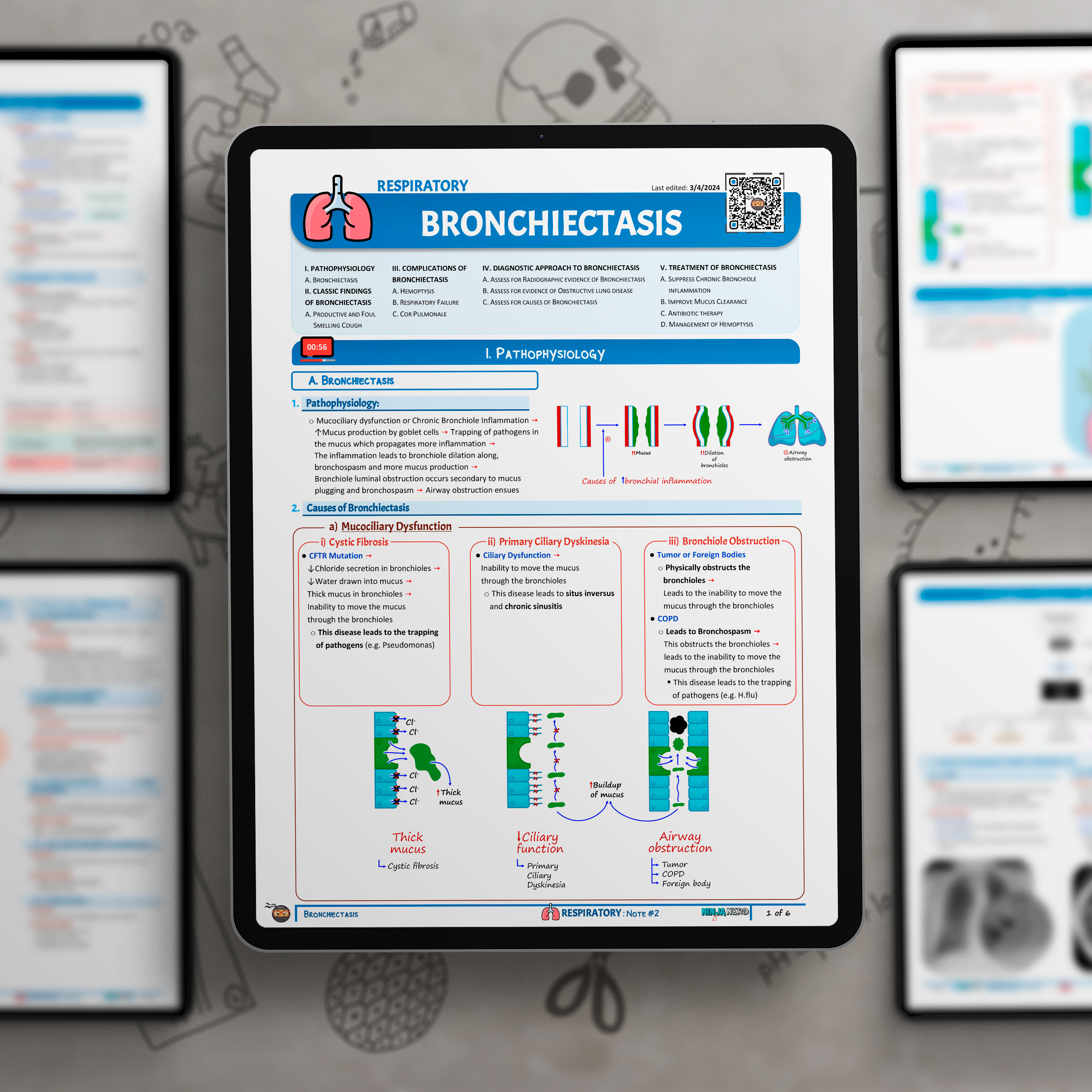 Bronchiectasis