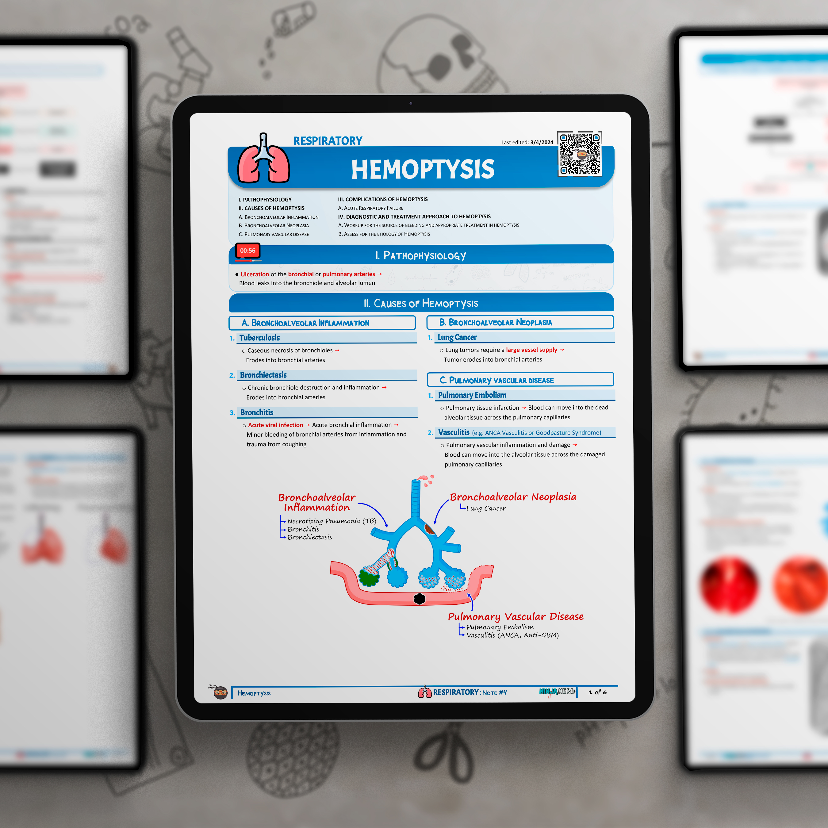 Hemoptysis